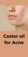 castor oil for acne