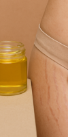 castor oil for stretch marks
